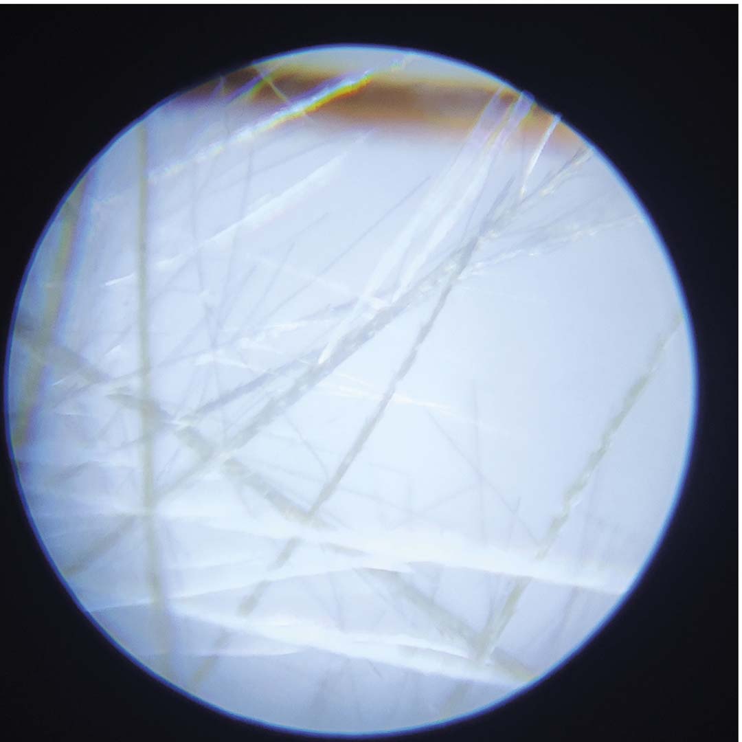 Close-up door de microscoop van witte, vezelige structuren.